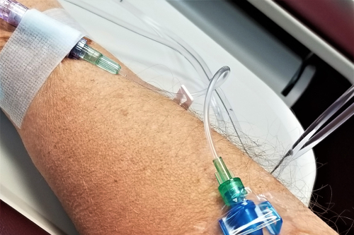 Tratamiento con quimioterapia